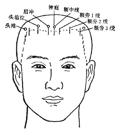 標準頭鍼図1
