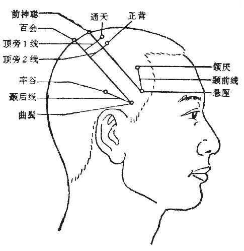 標準頭鍼図2